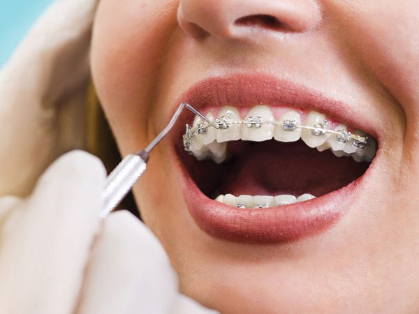 Dental Orthodontic image