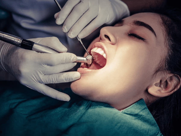 Affordable Root Canal Images